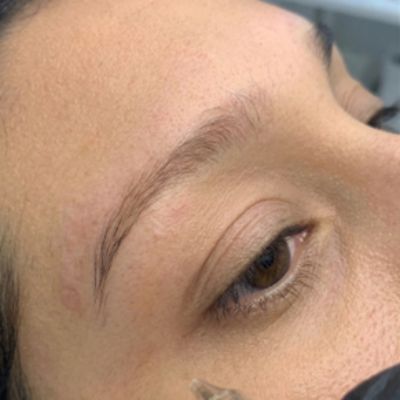 ¿Qué es la remoción de pigmentos en micropigmentación y cuándo se recomienda?